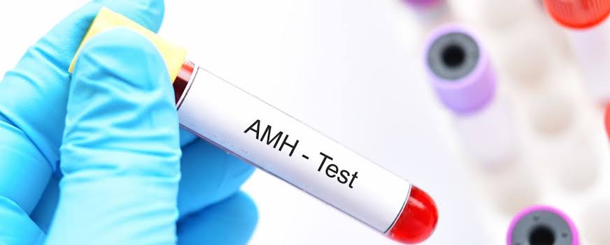 AMH Test in Noida Specialist