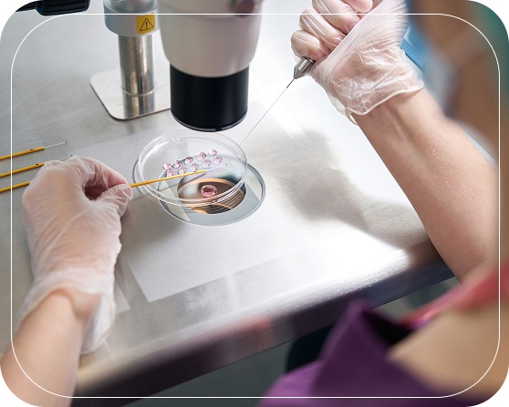 Blastocyst Transfer Treatment in Noida Process