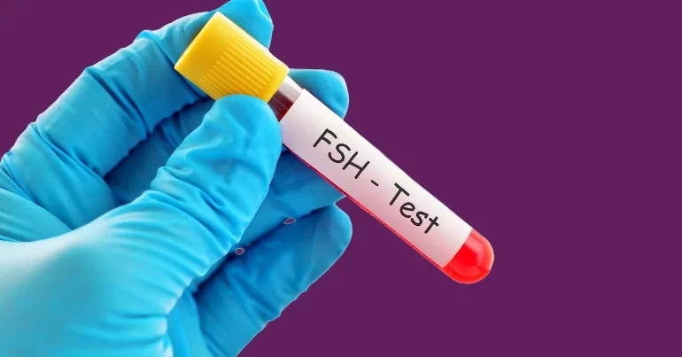 FSH & Estradiol Test in Noida Laboratory at Anaya IVF & Fertility Care