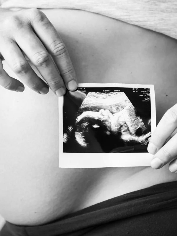Immune Fertility Test in Noida Specialist